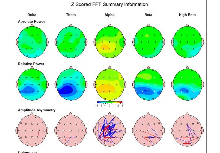 نقشه مغزی چیست؟